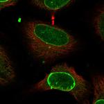 CCDC71 Polyclonal Antibody