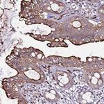 CCDC71 Antibody in Immunohistochemistry (Paraffin) (IHC (P))