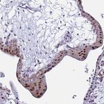 POP5 Polyclonal Antibody