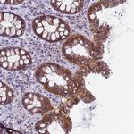 CDK2AP2 Antibody in Immunohistochemistry (Paraffin) (IHC (P))