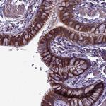 ELMOD2 Antibody in Immunohistochemistry (Paraffin) (IHC (P))