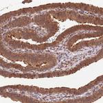 LRRC43 Polyclonal Antibody