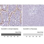 SLC23A1 Polyclonal Antibody