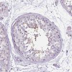 CEP19 Antibody in Immunohistochemistry (IHC)