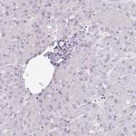 CEP19 Antibody in Immunohistochemistry (IHC)