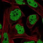 LRRC10B Polyclonal Antibody