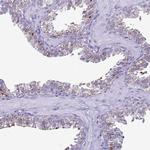 LRRC10B Antibody in Immunohistochemistry (Paraffin) (IHC (P))