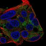 FBXL22 Polyclonal Antibody