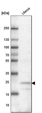FBXL22 Antibody in Western Blot (WB)