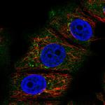 RABEP2 Polyclonal Antibody