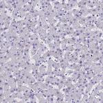 RABEP2 Antibody in Immunohistochemistry (Paraffin) (IHC (P))