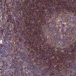 RABEP2 Antibody in Immunohistochemistry (Paraffin) (IHC (P))