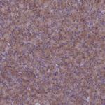 RABEP2 Antibody in Immunohistochemistry (Paraffin) (IHC (P))
