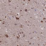 PYCR1 Antibody in Immunohistochemistry (Paraffin) (IHC (P))