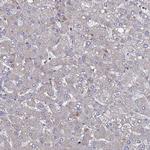 PYCR1 Antibody in Immunohistochemistry (Paraffin) (IHC (P))