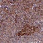 PYCR1 Antibody in Immunohistochemistry (Paraffin) (IHC (P))