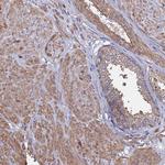 PYCR1 Polyclonal Antibody