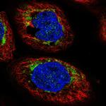 CHCHD6 Polyclonal Antibody