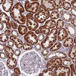 CHCHD6 Antibody in Immunohistochemistry (Paraffin) (IHC (P))