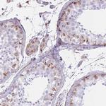 PTCD1 Antibody in Immunohistochemistry (Paraffin) (IHC (P))