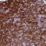 FAM84A Antibody in Immunohistochemistry (Paraffin) (IHC (P))
