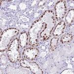 OR4F3 Polyclonal Antibody