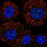 PLEKHH1 Polyclonal Antibody