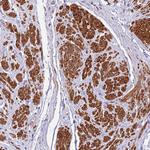 PLEKHH1 Antibody in Immunohistochemistry (Paraffin) (IHC (P))
