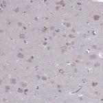 PET117 Antibody in Immunohistochemistry (Paraffin) (IHC (P))
