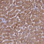 PET117 Antibody in Immunohistochemistry (Paraffin) (IHC (P))