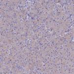 PET117 Antibody in Immunohistochemistry (Paraffin) (IHC (P))