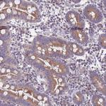 PET117 Antibody in Immunohistochemistry (Paraffin) (IHC (P))