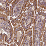 SLMO2 Antibody in Immunohistochemistry (Paraffin) (IHC (P))