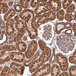 SLMO2 Antibody in Immunohistochemistry (Paraffin) (IHC (P))