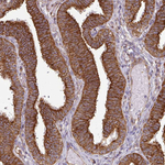 SLMO2 Antibody in Immunohistochemistry (Paraffin) (IHC (P))