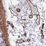 FAM198A Antibody in Immunohistochemistry (Paraffin) (IHC (P))