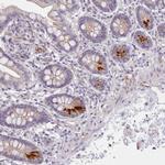 ZNF658 Antibody in Immunohistochemistry (Paraffin) (IHC (P))