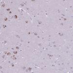 CNTNAP3 Polyclonal Antibody