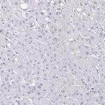 PADI2 Antibody in Immunohistochemistry (Paraffin) (IHC (P))