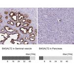 B4GALT2 Antibody