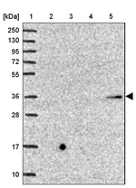 B4GALT2 Antibody in Western Blot (WB)