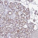 SMIM4 Antibody in Immunohistochemistry (Paraffin) (IHC (P))