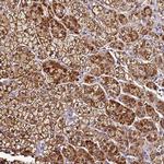 SMIM4 Antibody in Immunohistochemistry (IHC)