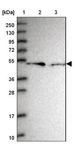 RMND5B Antibody in Western Blot (WB)