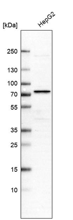 PCCA Antibody in Western Blot (WB)