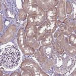 GPN3 Antibody in Immunohistochemistry (Paraffin) (IHC (P))