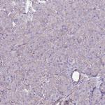 GPN3 Polyclonal Antibody