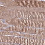 GPN3 Antibody in Immunohistochemistry (Paraffin) (IHC (P))