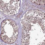 GPN3 Antibody in Immunohistochemistry (IHC)