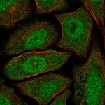 CABYR Polyclonal Antibody
